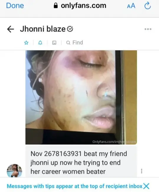 Beat Up Pic Of Jhonni Blaze Suggests She May Be A Victim Of Abuse & Sex Trafficking