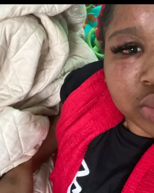 Rapper Popp Hunna Leaves Girlfriend With Bruises After Brutally Beating Her