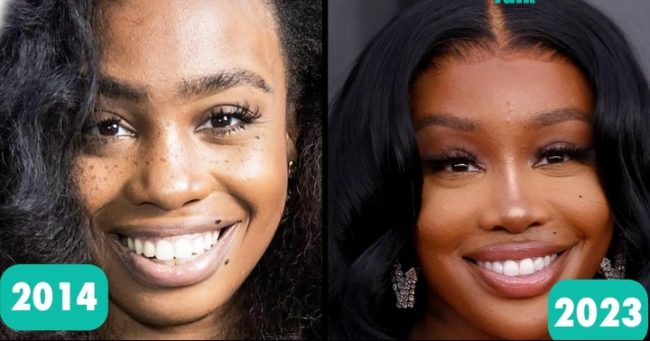 SZA Denies Ever Having Facial Surgery, Says It's High-Key Offensive